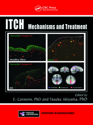 cover image of Itch